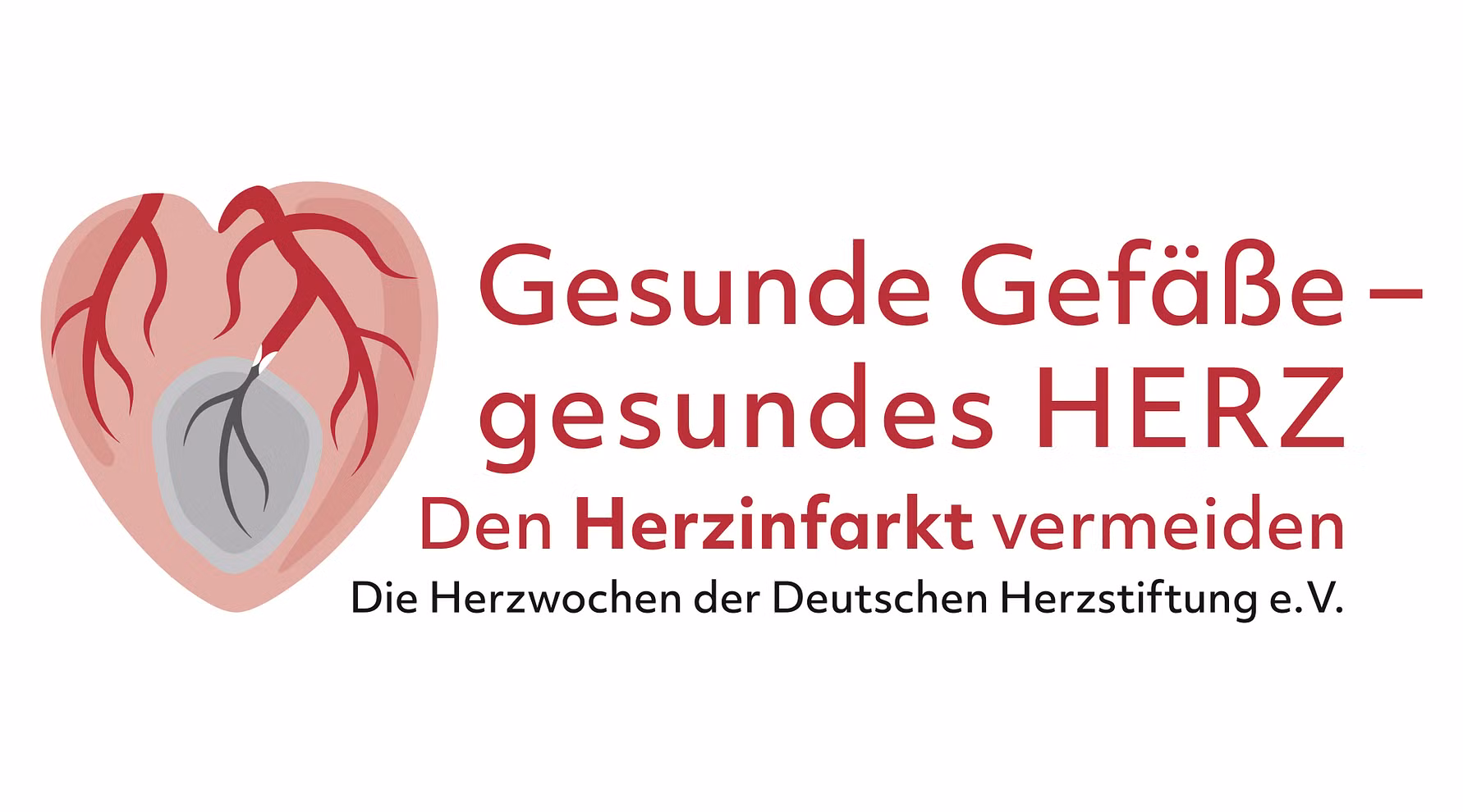 Gesunde Gefäße - gesundes Herz. Den Herinfarkt vermeiden. Die Herzwochen der Deutschen herzstiftung e.V,